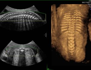 skeletal-rendering-spine